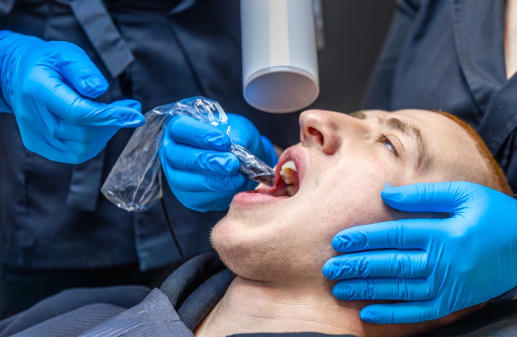 Tooth Extractions – Smile Design