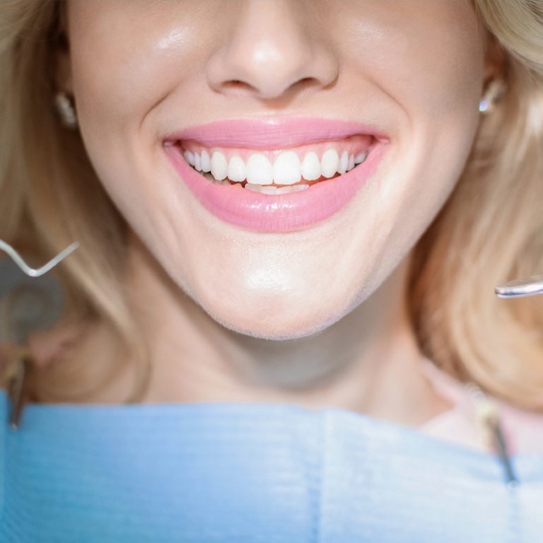 Smile-Design-(with-Veneers)