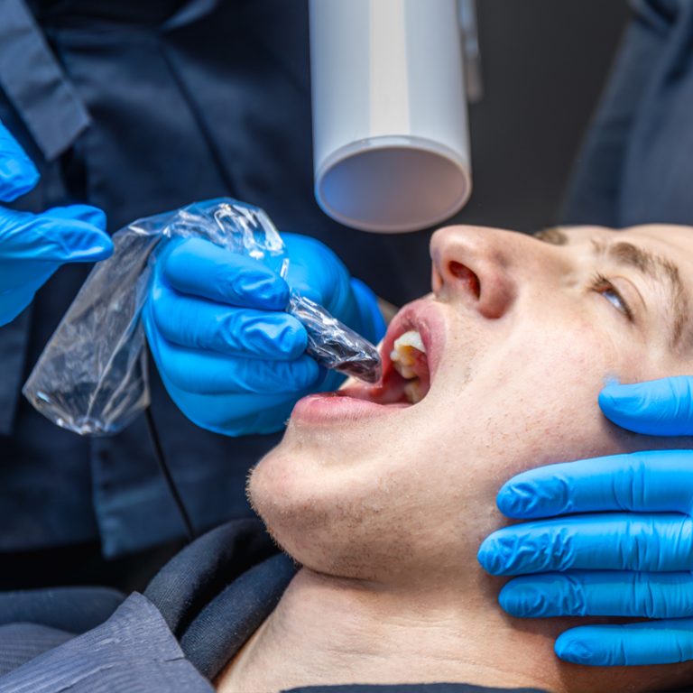Tooth-Extractions