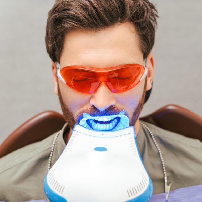 teeth-whitening